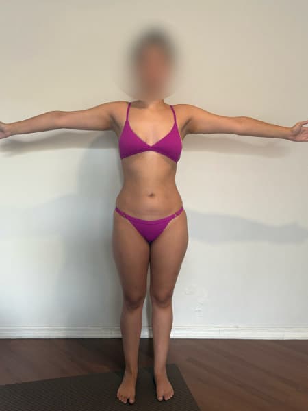 antes_depois_1_2