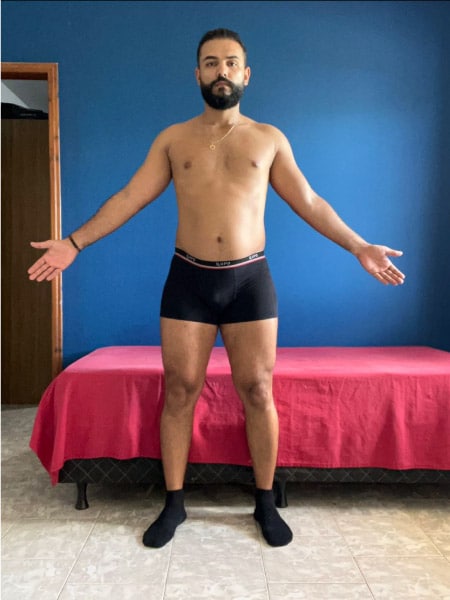 antes_depois_3_1