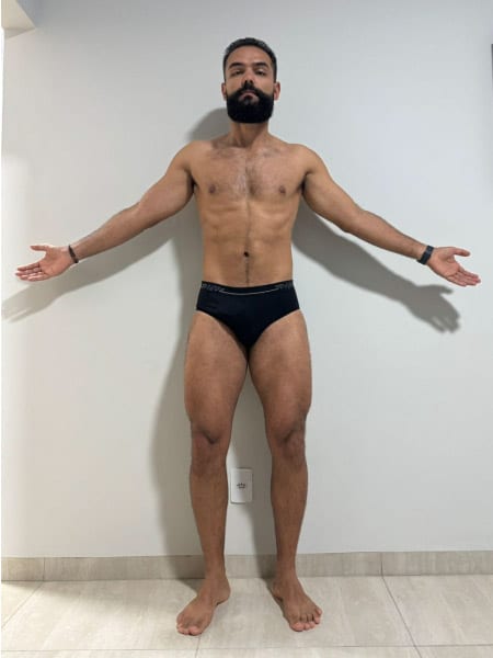 antes_depois_3_2